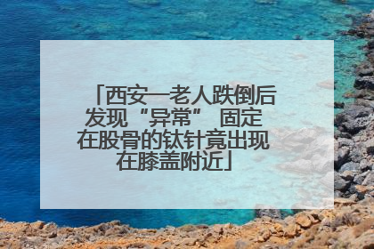 西安一老人跌倒后发现“异常” 固定在股骨的钛针竟出现在膝盖附近